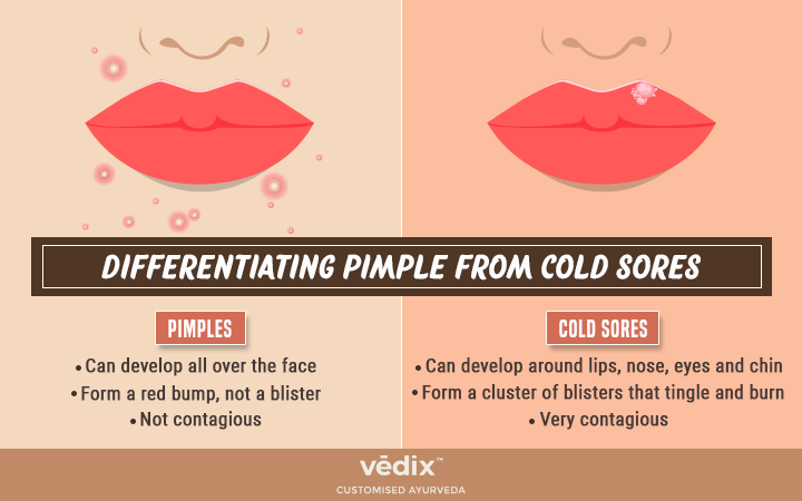 herpes vs pimple