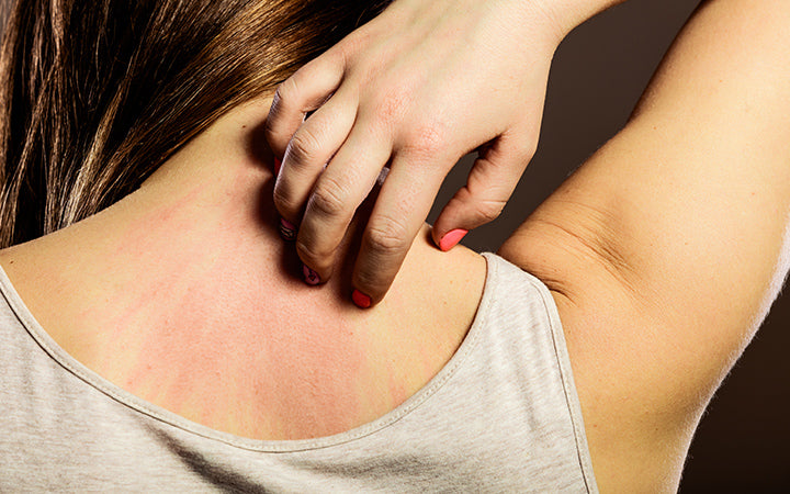 How To Treat Skin Rashes With Ayurvedic Solutions? – Vedix