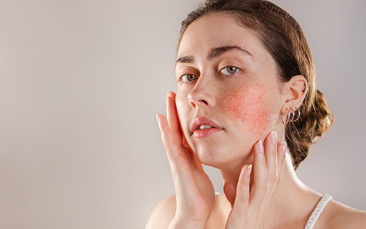 Sensitive Skin Care: The Signs & Symptoms