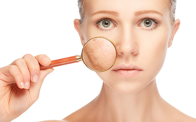 How To Reduce Skin Pigmentation With Ayurvedic Solutions?