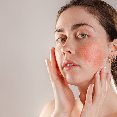 How To Treat Skin Inflammation With Ayurveda?