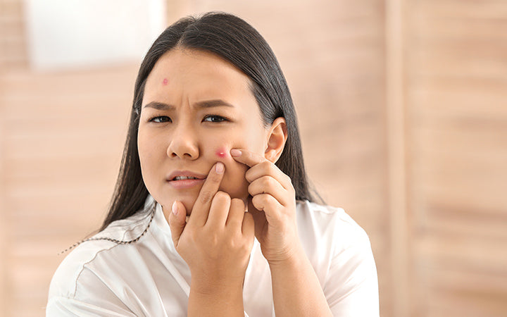 Ayurvedic Remedies To Get Rid Of Pimples – Vedix