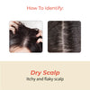 Shvedan Hair Fall Oil for Dry Scalp