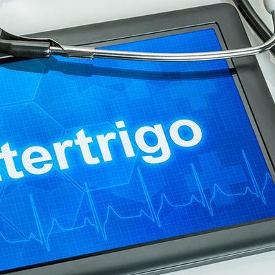 All You Need To Know About Intertrigo