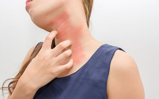 How To Treat Itchy Skin With Ayurveda?