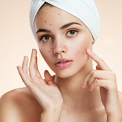 How To Treat Blemishes On Your Face With Ayurveda?