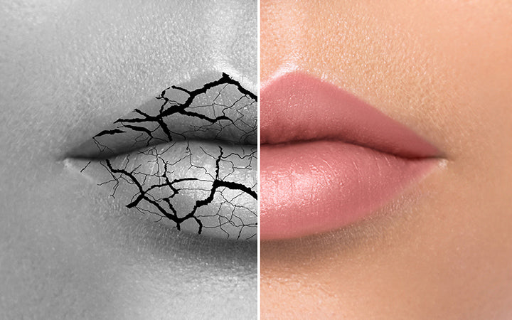 9 Effective Ways To Cure Chapped Lips Effectively