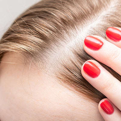 How To Prevent Balding With Ayurvedic Solutions?