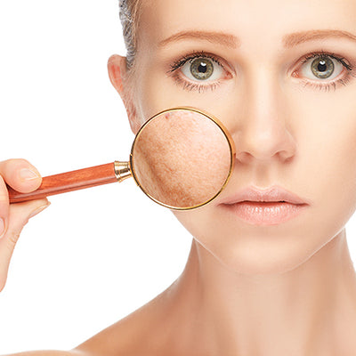 How To Reduce Skin Pigmentation With Ayurvedic Solutions?