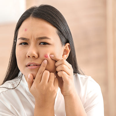 Ayurvedic Remedies To Get Rid Of Pimples