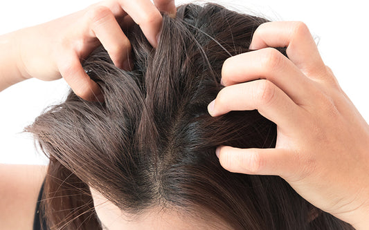 How To Treat Dry Scalp With Ayurvedic Remedies?
