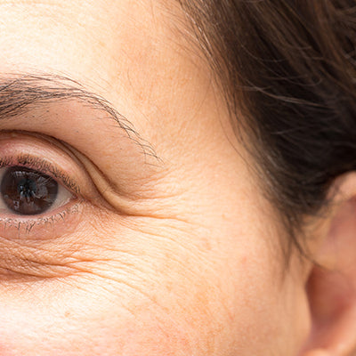 How To Treat Dry Skin Around Your Eyes With Ayurvedic Solutions?