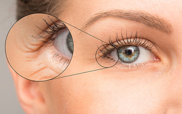 6 Foods That Can Give You Puffy Eyes, and 4 That Can Fix Them / Bright Side