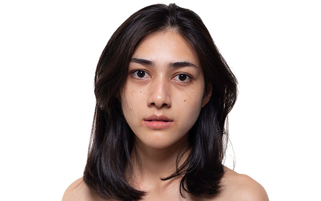 What Causes Sallow Skin & How To Manage It? – Vedix