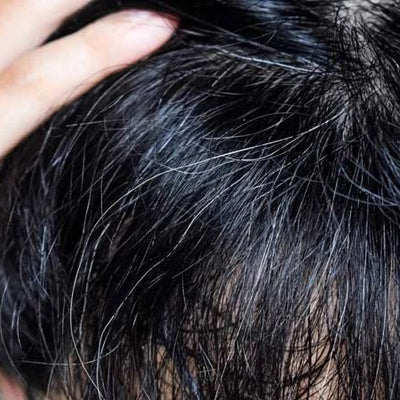 5 Quick Solutions To Reverse Your Premature Grey Hair