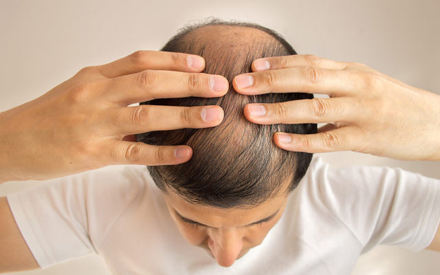Common Hair Problems And Their Treatments – Vedix
