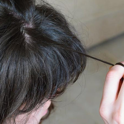 Trichotillomania(Hair Pulling Disorder): Symptoms & Treatment