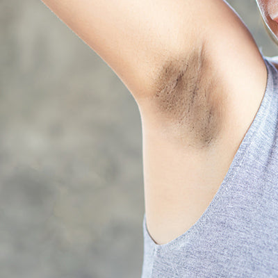 How To Get Rid of Dark Underarms with Herbal Remedies? – Vedix