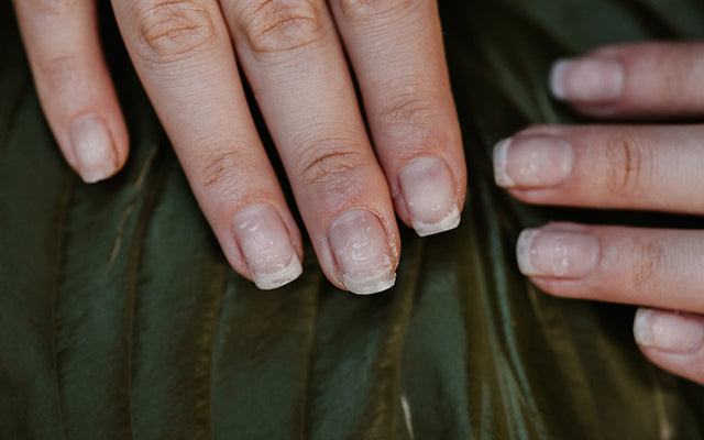How To Treat Your Dark Cuticles With Ayurveda?