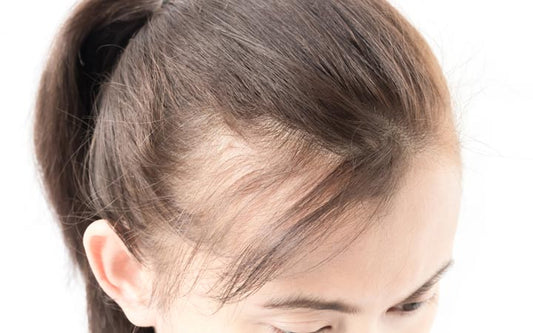 woman serious hair loss problem