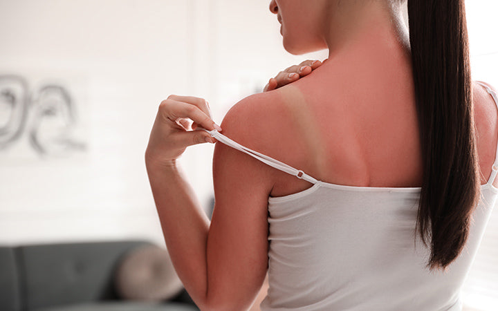 10 Natural Ways To Remove Tan From Hands & Legs – Vedix