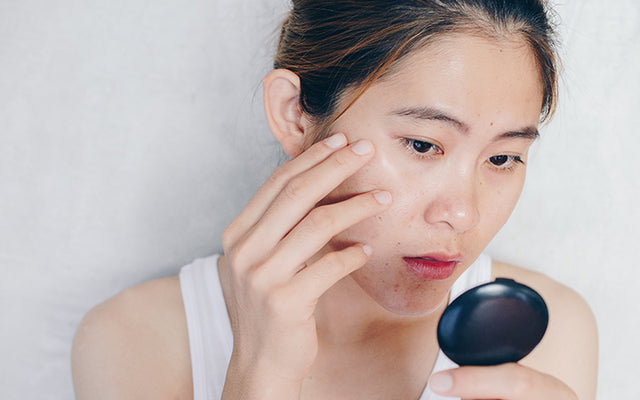 How To Balance Sebum Production On The Face/ Skin?