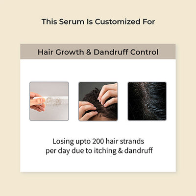 Nuyantra Pro Hair Growth Serum x Dandruff Care For Men