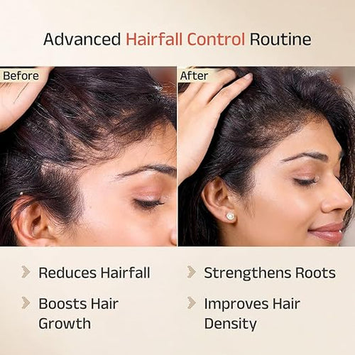 Keshamrut 3 Step Severe Hairfall Regimen for Normal Hair