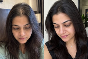 Keshamrut Before After