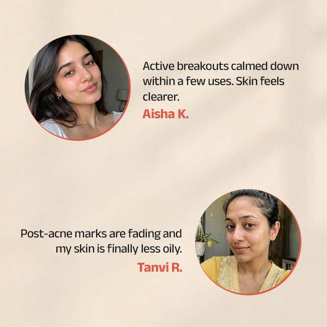 Prakhya Acne Rescue Regimen With Serum, Face Wash & Face Gel – Vedix