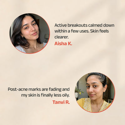 Prakhya Face Serum With Durva & Nimba