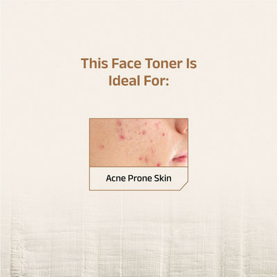 Vaimal Toner With Witch Hazel & Salicylic Acid