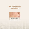 Vaimal Toner With Witch Hazel & Salicylic Acid
