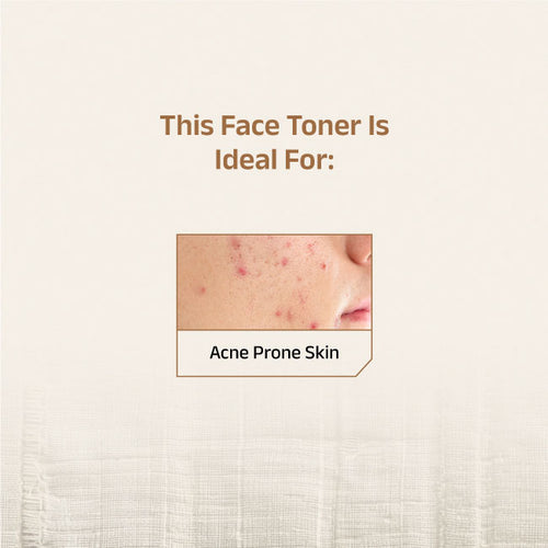 Vaimal Toner With Witch Hazel & Salicylic Acid