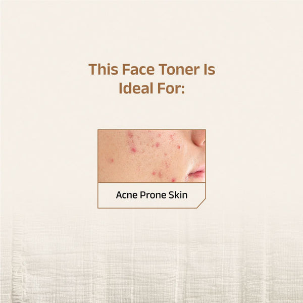 Vaimal Toner With Witch Hazel & Salicylic Acid