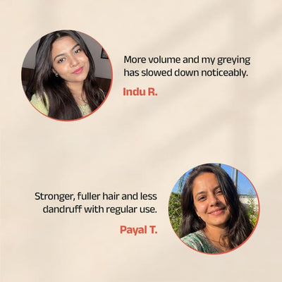 Vithan Advanced Hair Serum With Onion & Aloe Vera