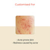 Avasya Clarifying Clay Mask For Acne Prone Skin